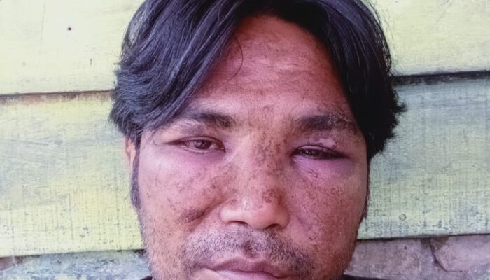 Oknum Polisi Belawan Hajar Wartawan