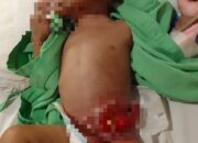 Paska Operasi Aidil di RS Swasta, Keluarga Terhutang 40 Jt, Kini Butuh Uluran Para Donatur