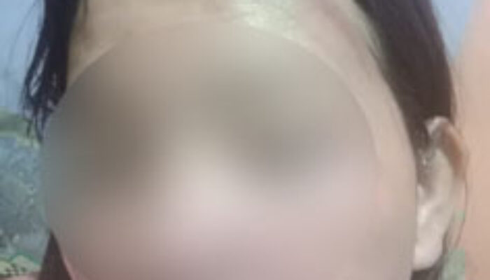 Megawati Laporkan Suaminya ke Polres Labuhan Batu atas KDRT